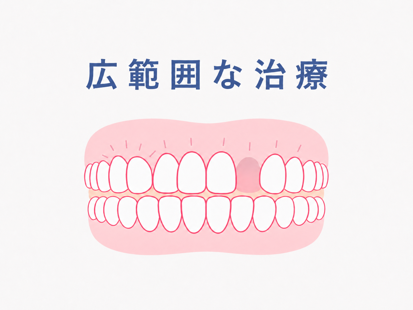 ヘビー