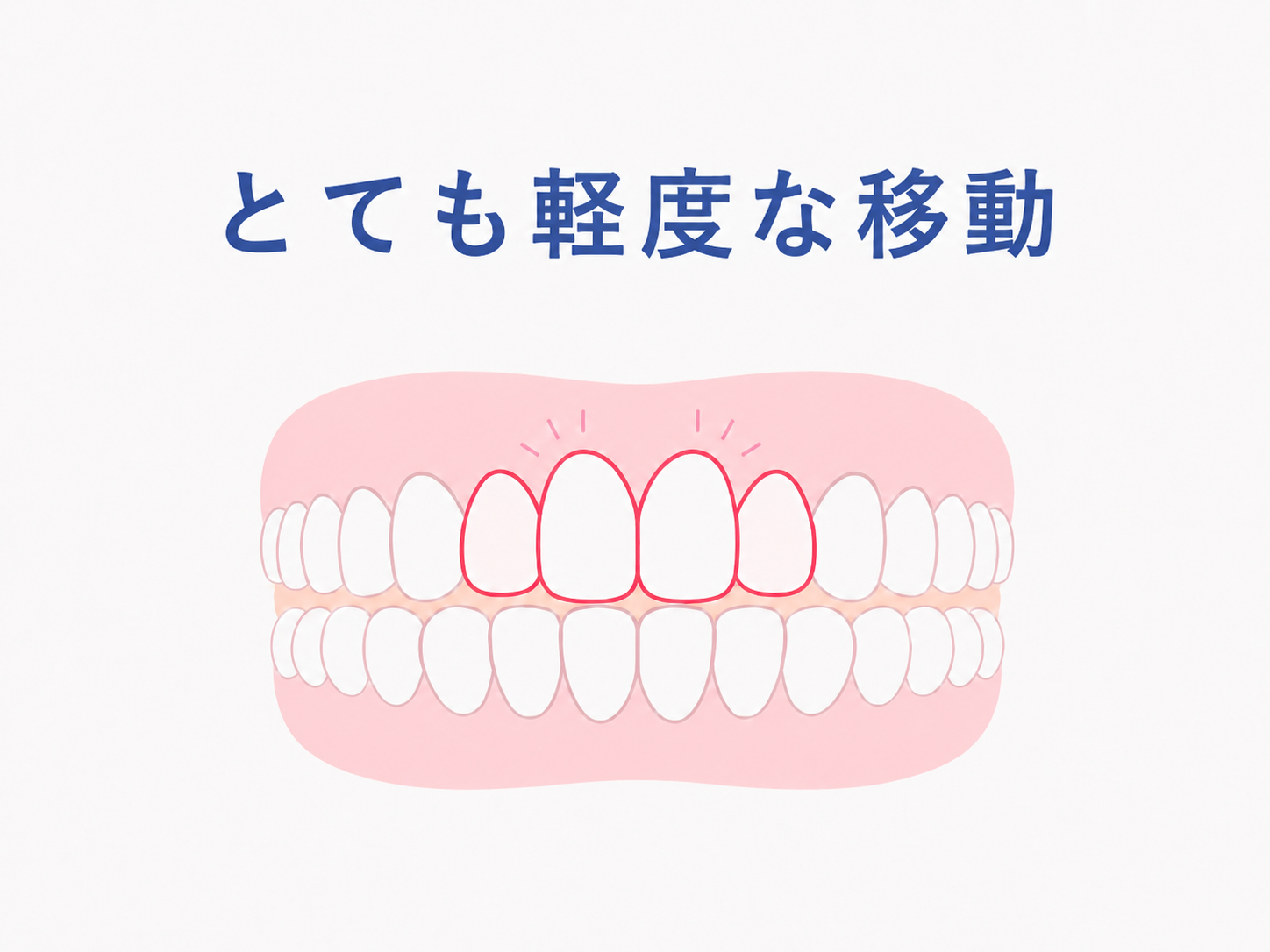 ベリーイージー